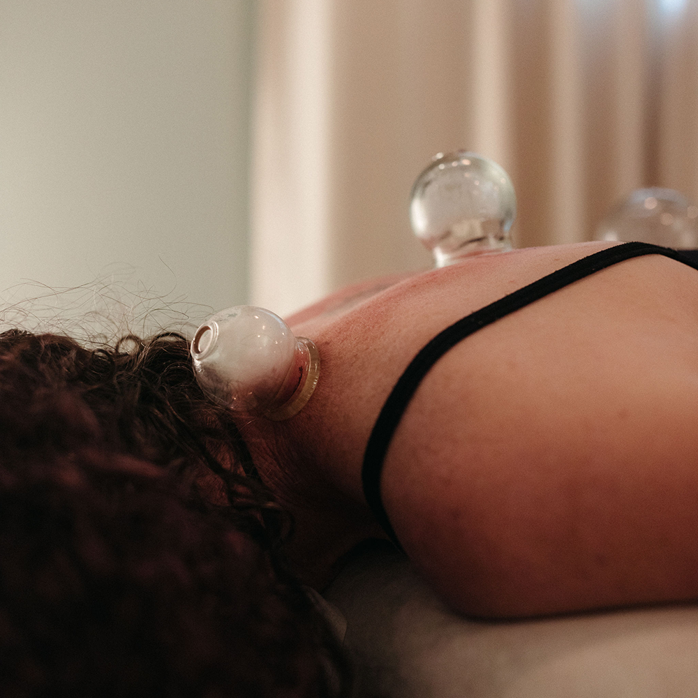 Gua sha and cupping in Portland OR - cupping for back pain